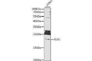 Western blot analysis of extracts of 22Rv1 cells, using RLN1 antibody (ABIN7269906) at 1:1000 dilution. (Relaxin 1 antibody  (AA 1-100))