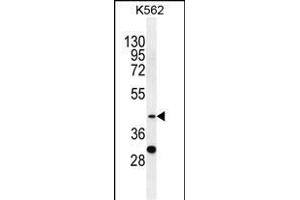 SERPINB4 antibody  (C-Term)