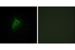 Immunofluorescence analysis of HepG2 cells, using Adrenergic Receptor alpha-2B antibody. (ADRA2B antibody)