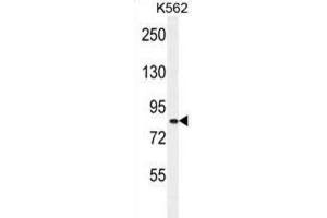 Western Blotting (WB) image for anti-Deafness, Autosomal Recessive 31 (DFNB31) antibody (ABIN2996024) (DFNB31 antibody)