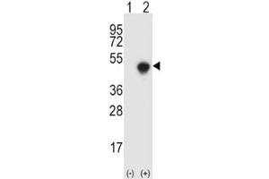 Western blot analysis of SPHK1 antibody and 293 cell lysate either nontransfected (Lane 1) or transiently transfected (2) with the SPHK1 gene.