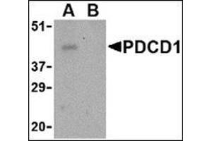 Western blot analysis of PD-1 in THP-1 cell lysate with this product at 1 μg/ml in the (A) absence and (B) presence of blocking peptide. (PD-1 antibody  (Center))
