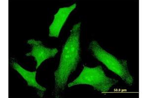 Immunofluorescence of monoclonal antibody to IL6 on HeLa cell. (IL-6 antibody  (AA 29-212))