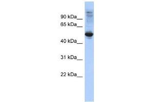 FBXL16 antibody used at 1 ug/ml to detect target protein. (FBXL16 antibody  (Middle Region))