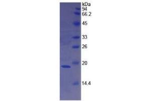 SDS-PAGE analysis of Human F8 Protein.