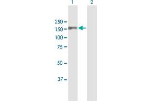 Western Blot analysis of MCM2 expression in transfected 293T cell line by MCM2 MaxPab polyclonal antibody. (MCM2 antibody  (AA 1-904))