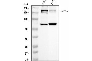 Western blot analysis of SBNO1 using anti-SBNO1 antibody (ABIN7601710).