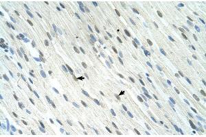 Human Muscle; SERTAD1 antibody - N-terminal region in Human Muscle cells using Immunohistochemistry (SERTAD1 antibody  (N-Term))