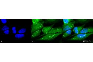 Immunocytochemistry/Immunofluorescence analysis using Rabbit Anti-p38 Polyclonal Antibody . (MAPK14 antibody  (FITC))