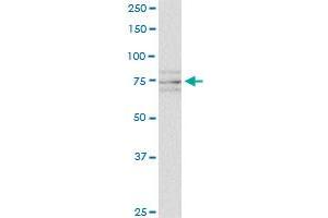 SCYL1 monoclonal antibody (M02), clone 2E5. (SCYL1 antibody  (AA 373-472))