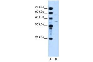 Image no. 1 for anti-Dihydroorotate Dehydrogenase (DHODH) (AA 112-161) antibody (ABIN204980) (DHODH antibody  (AA 112-161))