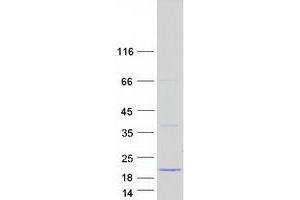 Validation with Western Blot (TCL1A Protein (Transcript Variant 2) (Myc-DYKDDDDK Tag))