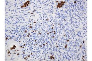 Image no. 1 for anti-CNKSR Family Member 3 (CNKSR3) antibody (ABIN1497550) (CNKSR3 antibody)