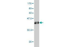 Western Blot detection against Immunogen (36. (ANKRD15 antibody  (AA 701-800))