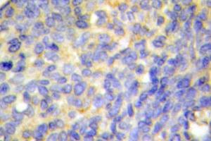 Image no. 2 for anti-DNA Fragmentation Factor, 45kDa, alpha Polypeptide (DFFA) antibody (ABIN272297) (DFFA antibody)