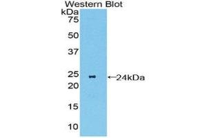 Western Blotting (WB) image for anti-Macrophage Stimulating 1 Receptor (C-Met-Related tyrosine Kinase) (MST1R) (AA 89-275) antibody (ABIN1859892) (MST1R antibody  (AA 89-275))