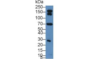 Western blot analysis of Rat Serum, using Rat C3a Antibody (2 µg/ml) and HRP-conjugated Goat Anti-Rabbit antibody (