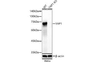 Western Blotting (WB) image for anti-Yes-Associated Protein 1 (YAP1) antibody (ABIN7271418)