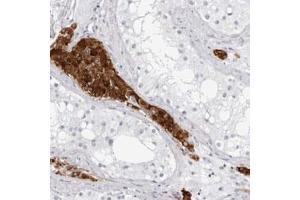 Immunohistochemical staining (Formalin-fixed paraffin-embedded sections) of human testis with INSL3 polyclonal antibody  shows strong cytoplasmic positivity in Leydig cells. (INSL3 antibody)