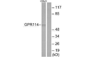 Western blot analysis of extracts from COLO cells, using GPR114 antibody. (GPR114 antibody  (Internal Region))