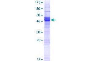 PRUNE2 Protein (AA 1-191) (GST tag)