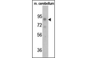 Image no. 3 for anti-Fibroblast Growth Factor Receptor 1 (FGFR1) (pTyr766) antibody (ABIN358128) (FGFR1 antibody  (pTyr766))