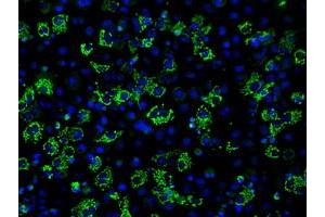 Image no. 2 for anti-Aconitase 2, Mitochondrial (ACO2) antibody (ABIN1496412) (ACO2 antibody)
