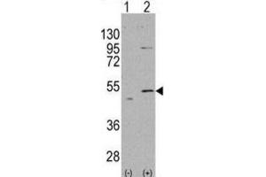Western Blotting (WB) image for anti-Aldehyde Dehydrogenase 5 Family, Member A1 (ALDH5A1) antibody (ABIN2998188)
