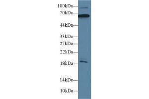 Detection of CAMK2g in Mouse Cerebrum lysate using Polyclonal Antibody to Calcium/Calmodulin Dependent Protein Kinase II Gamma (CAMK2g) (CAMKII gamma antibody  (AA 6-208))