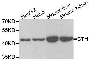Western blot analysis of extracts of various cell lines, using CTH antibody. (CTH antibody  (AA 1-405))