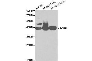 Western blot analysis of extracts of various cell lines, using SORD antibody. (SORD antibody  (AA 1-357))
