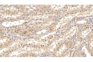 Immunohistochemistry (IHC) image for anti-Fibroblast Activation Protein, alpha (FAP) (AA 523-760) antibody (ABIN7426517)