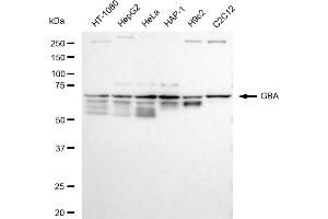 Western blotting analysis using GBA antibody (ABIN7798735).