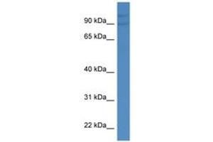 Image no. 1 for anti-Cyclin D Binding Myb-Like Transcription Factor 1 (DMTF1) (AA 33-82) antibody (ABIN6746171) (DMP1 antibody  (AA 33-82))