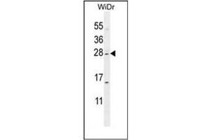 Western blot analysis of IQCF1 Antibody (N-term) in WiDr cell line lysates (35ug/lane).
