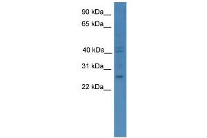 WB Suggested Anti-GCH1 Antibody Titration: 0. (GCH1 antibody  (C-Term))