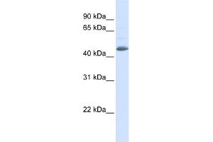 WB Suggested Anti-SNX5 Antibody Titration: 0.
