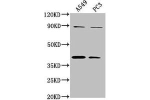 Western Blot Positive WB detected in: A549 whole cell lysate, PC3 whole cell lysate All lanes: ATP6V0D2 antibody at 1:2000 Secondary Goat polyclonal to rabbit IgG at 1/50000 dilution Predicted band size: 41 kDa Observed band size: 41 kDa (ATP6VD2 (AA 50-295) antibody)