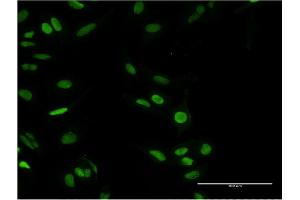 Immunofluorescence of monoclonal antibody to PARP1 on HeLa cell. (PARP1 antibody  (AA 1-100))
