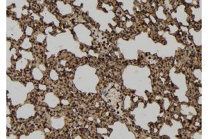 ABIN6277288 at 1/100 staining Mouse lung tissue by IHC-P. (Neural Wiskott-Aldrich syndrome protein (WASL) (Internal Region) antibody)