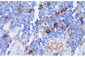 Immunohistochemistry of paraffin-embedded Rat bone marrow using PADI4 Polyclonal Antibody at dilution of 1:100 (40x lens). (PAD4 antibody)