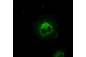 Image no. 6 for anti-Crystallin, alpha B (CRYAB) antibody (ABIN1497644) (CRYAB antibody)