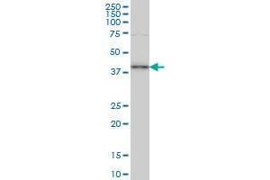 TFAP4 monoclonal antibody (M03), clone 7A10 Western Blot analysis of TFAP4 expression in Hela S3 NE . (TFAP4 antibody  (AA 93-192))