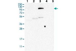 Western blot analysis of Lane 1: RT-4, Lane 2: U-251 MG, Lane 3: Human Plasma, Lane 4: Liver, Lane 5: Tonsil with LEMD3 polyclonal antibody . (LEMD3 antibody)