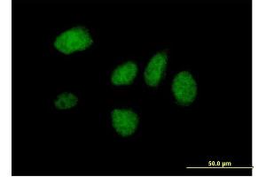 Immunofluorescence of purified MaxPab antibody to DIDO1 on HeLa cell. (DIDO1 antibody  (AA 1-544))
