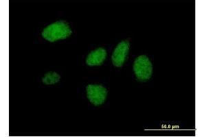 Immunofluorescence of purified MaxPab antibody to DIDO1 on HeLa cell.