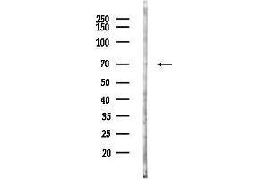 anti-Acyl-CoA Thioesterase 11 (ACOT11) (Internal Region) antibody