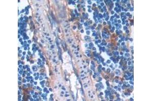 IHC-P analysis of Rat Tissue, with DAB staining. (PIM2 antibody  (AA 34-292))