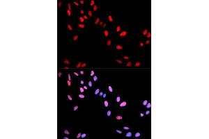 Immunofluorescence analysis of U2OS cell using Phospho-MYC-T58 antibody.