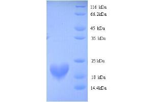 SDS-PAGE (SDS) image for RNA Binding Motif Protein 3 (RBM3) (AA 1-157), (full length) protein (His tag) (ABIN4975655)